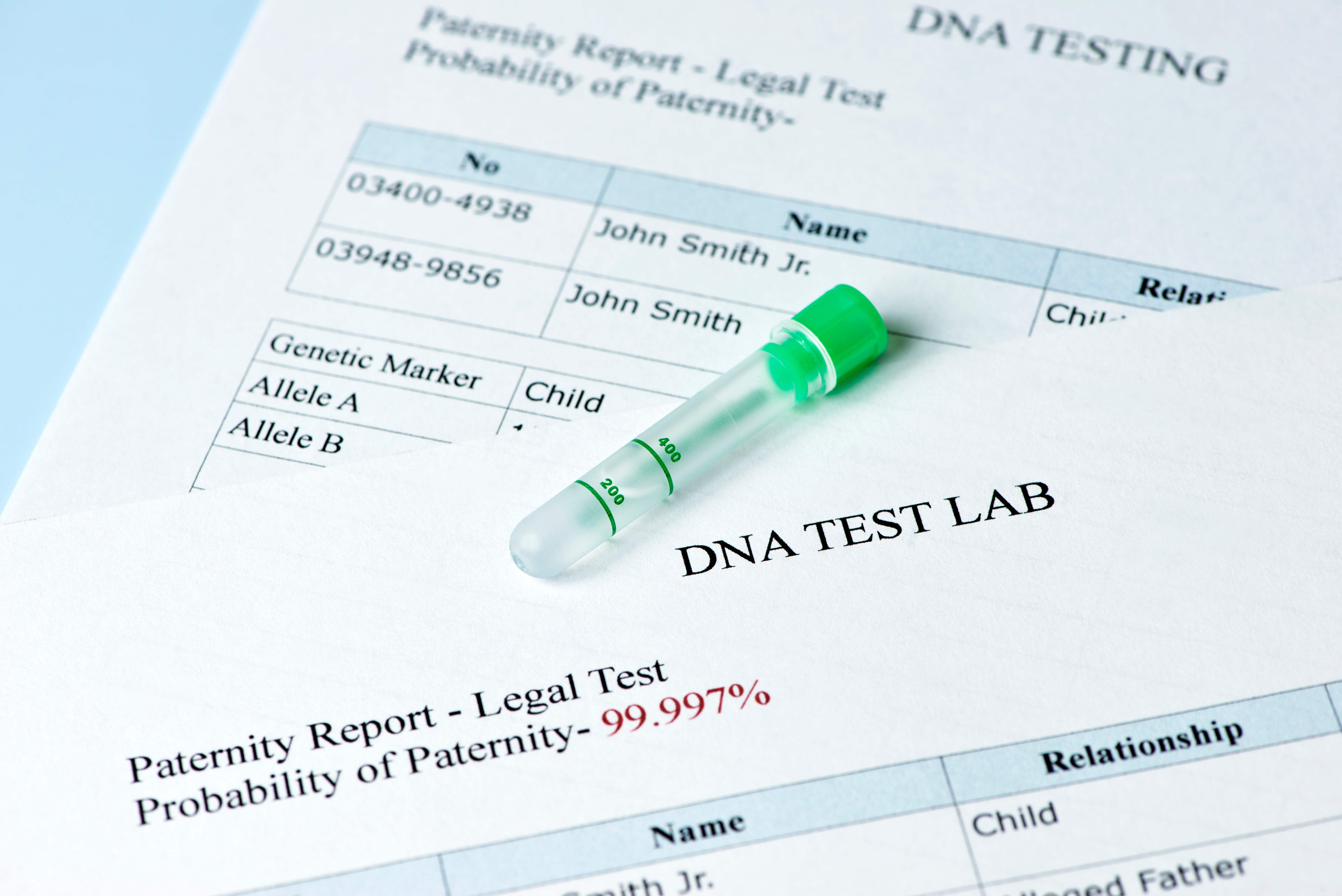DNA-Vaterschaftstest mit Laborprobe und Testergebnis